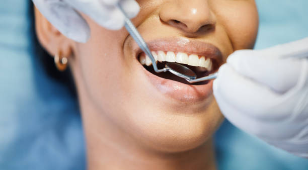 Best Broken or Cracked Tooth Emergency Dentist in Framingham, MA
