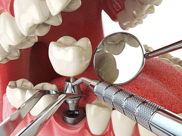Best Emergency Cosmetic Dentistry in Framingham, MA